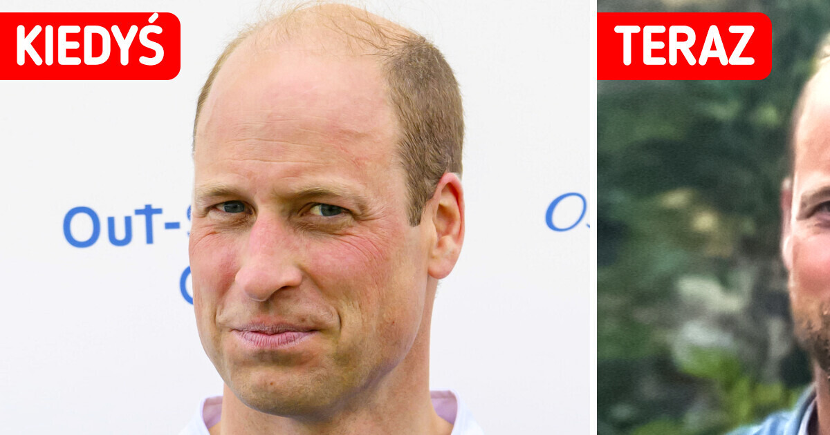 „Co za przystojniak” — książę William ujawnia swój nowy image z brodą i szokuje fanów „Co za przystojniak” — książę William ujawnia swój nowy image z brodą i szokuje fanów