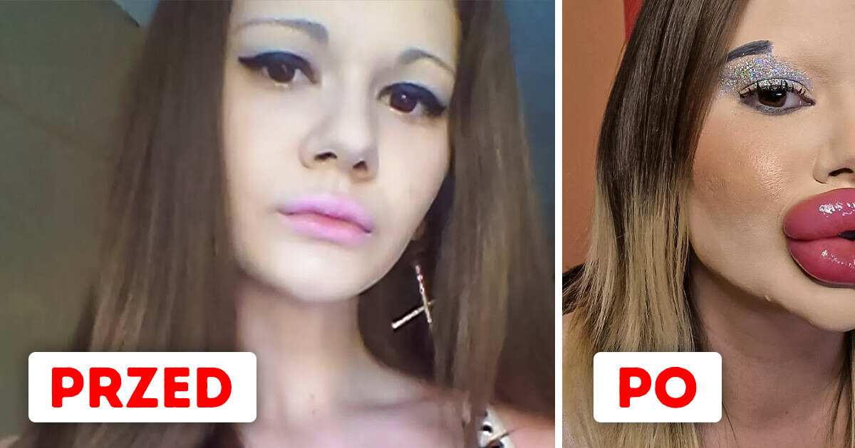 Poznajcie kobietę, która ma największe usta na świecie i chce jeszcze bardziej je powiększyć