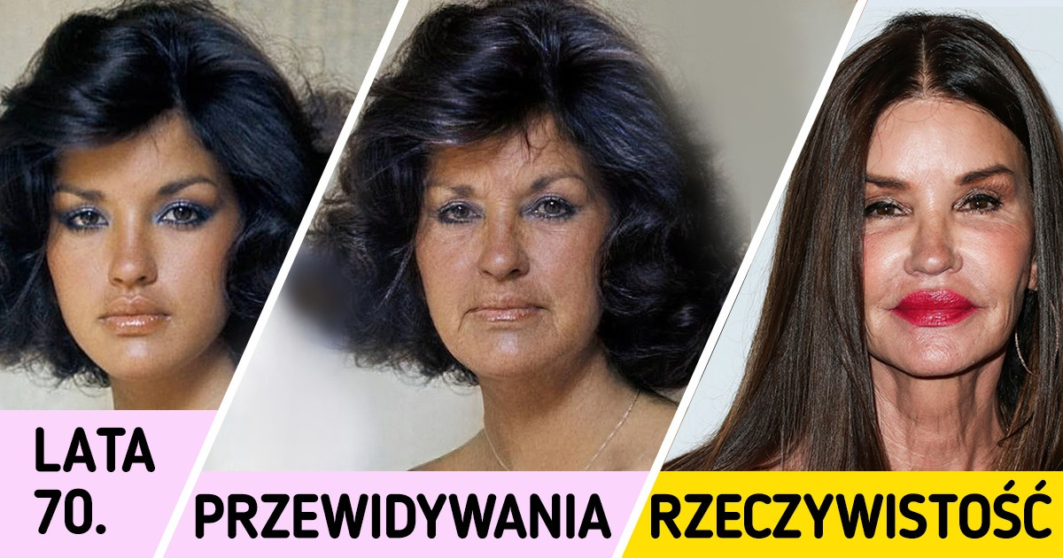 Jak wyglądałoby 10 gwiazd, gdyby nigdy nie poddały się zabiegom medycyny estetycznej
