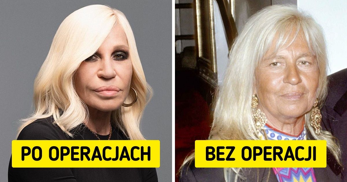 Jak wyglądałyby gwiazdy, gdyby nie poddawały się operacjom plastycznym