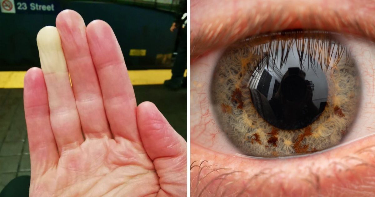 19 osób obdarzonych wyjątkowymi cechami fizycznymi