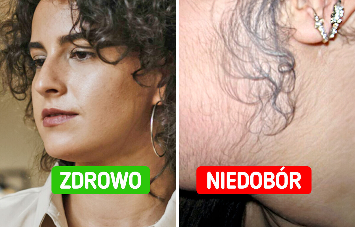 5 oznak, że twoje ciało potrzebuje więcej witaminy D