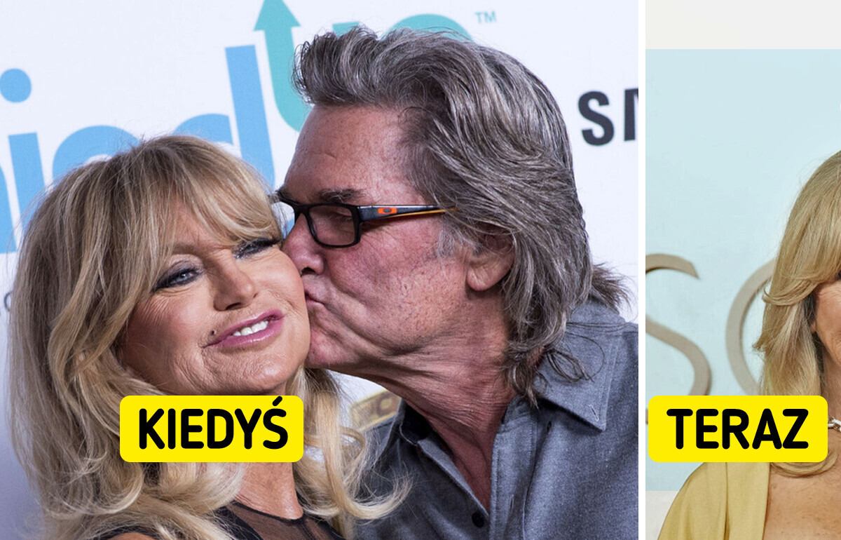 „Jej twarz. Co się stało?”. Goldie Hawn ujawnia, na co cierpi, ale ludzie widzą jedno
