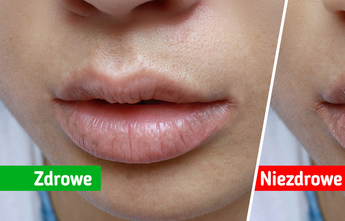 7 sygnałów, które twoje ciało wysyła w razie problemów ze zdrowiem