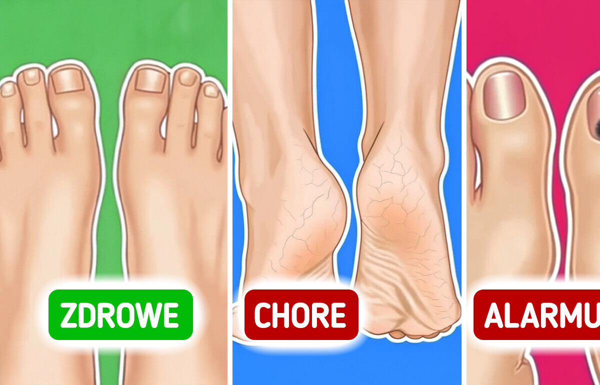 5 alarmujących sygnałów na twoich stopach, których nie wolno ignorować