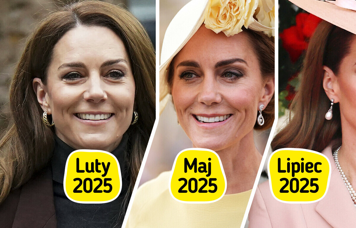 Twarz księżnej Kate się zmienia? W sieci narasta fala spekulacji