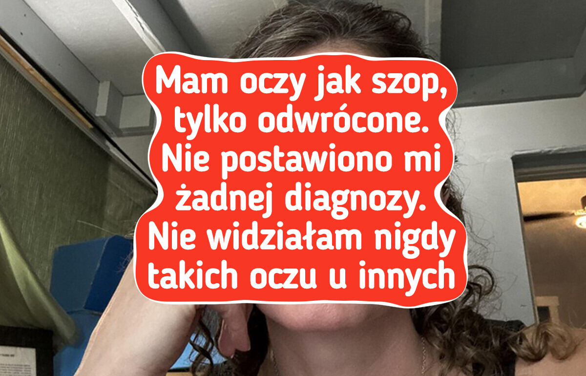 15 osób, które natura obdarzyła wyjątkowymi cechami
