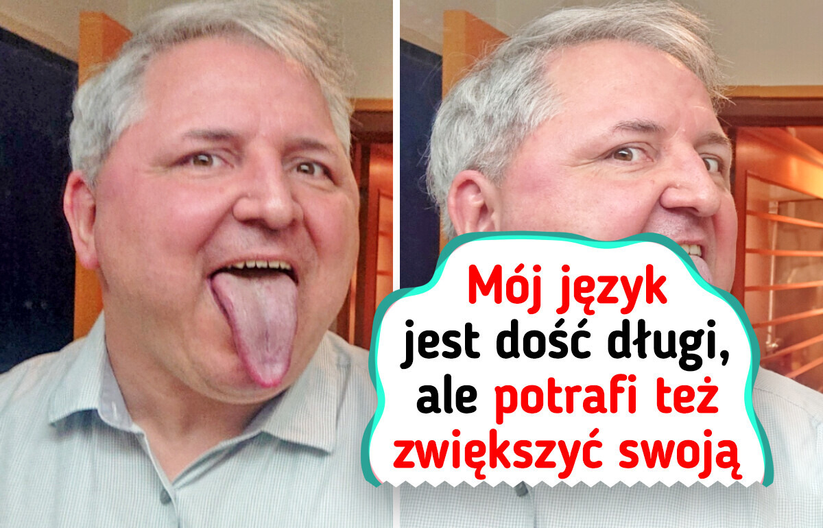 15 nietypowych cech, których właściciele mogą czuć się niepowtarzalni