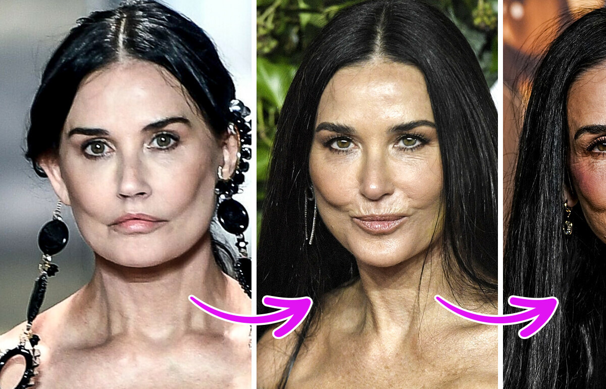 Demi Moore zrezygnowała z wypełniaczy? Eksperci zauważają zmiany