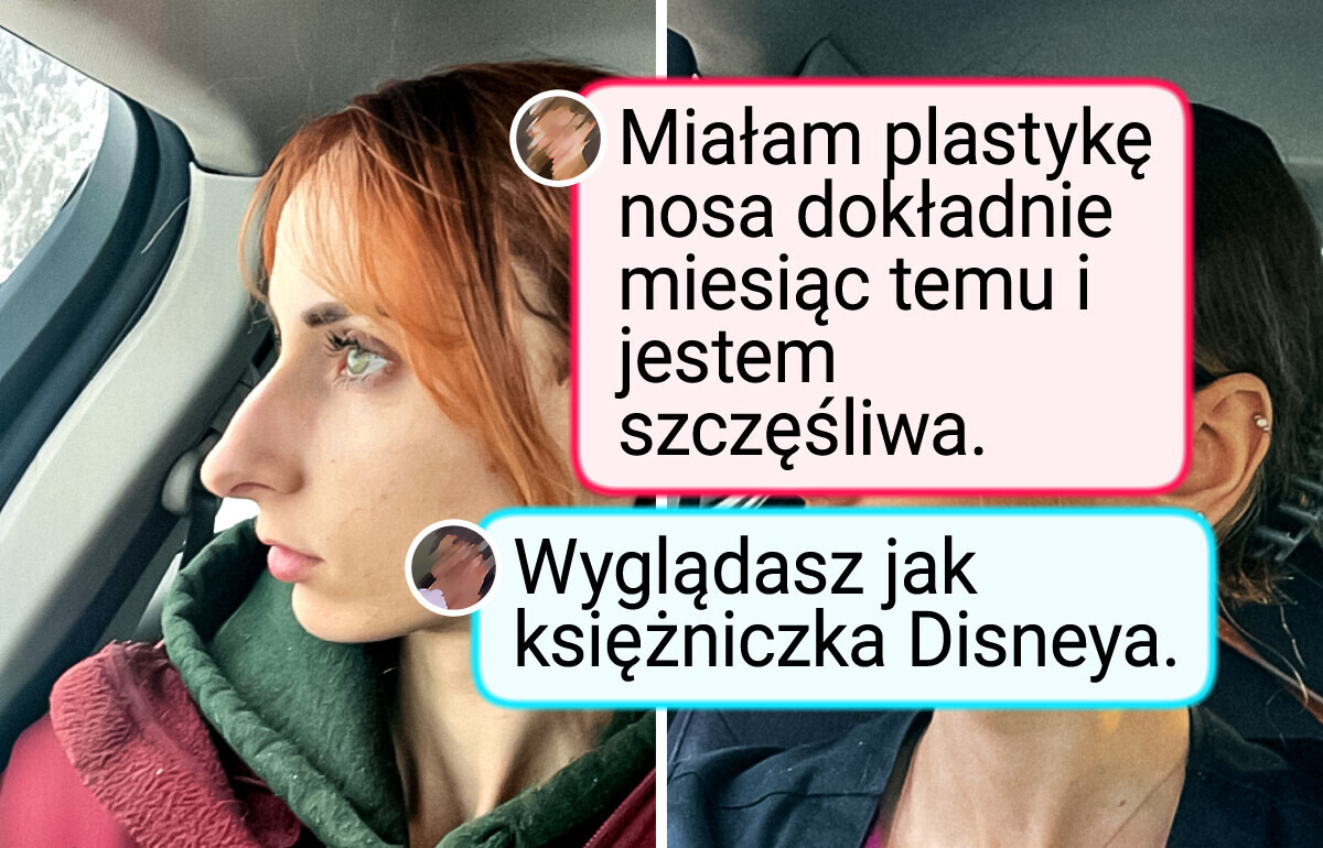 13 zestawień zdjęć „przed i po”, które pokazują niezwykłą metamorfozę