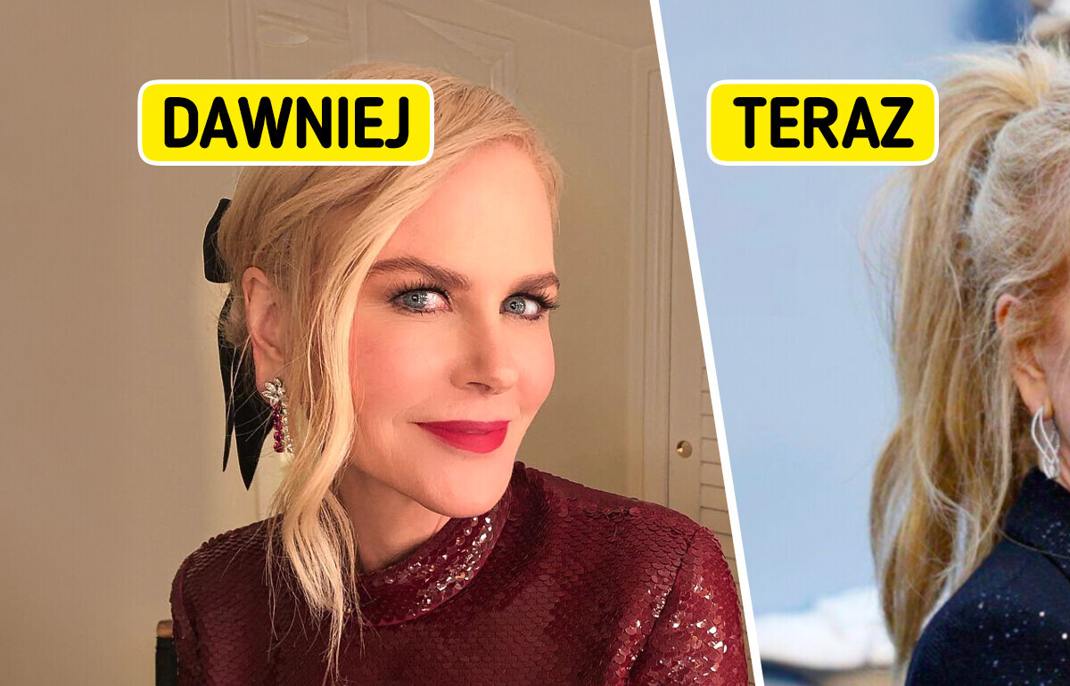 „Wskaźniki liftingu twarzy w pobliżu uszu” — Nicole Kidman szokuje swoją ostatnią przemianą, a ludzie zauważają jeden szczegół