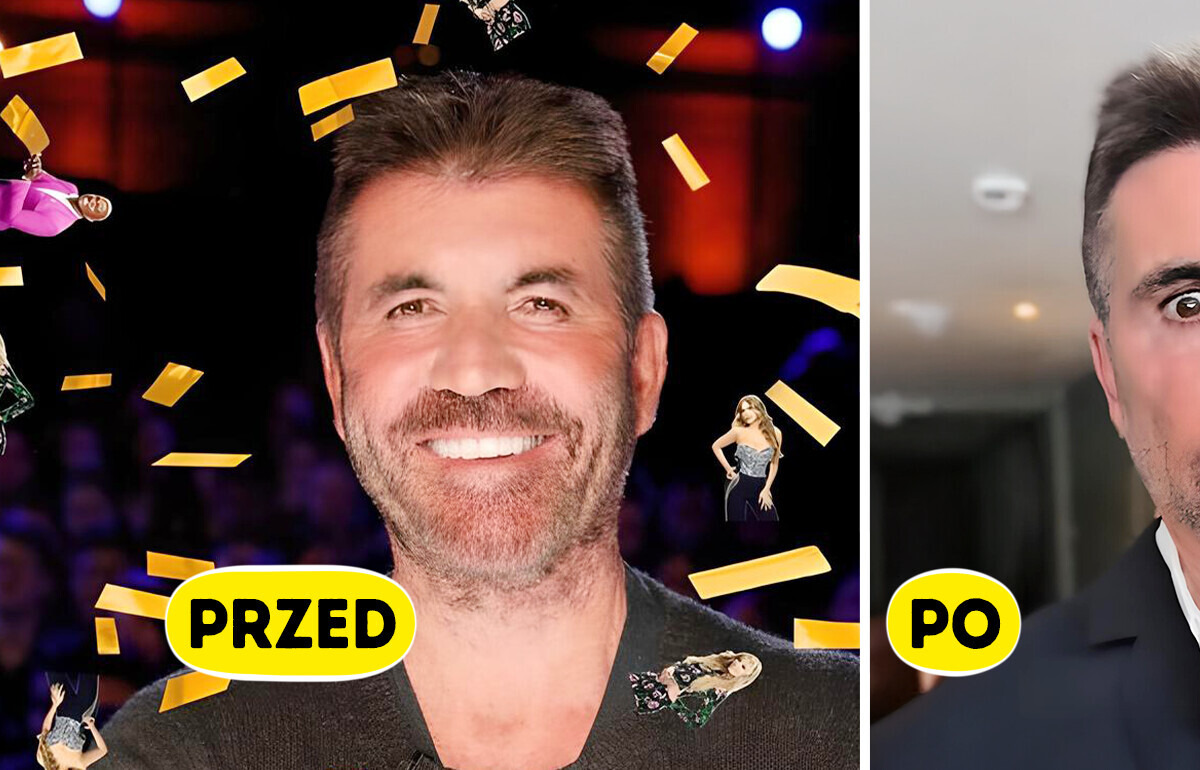 „Co się stało z jego twarzą?!” — nowy wygląd Simona Cowella zaniepokoił fanów