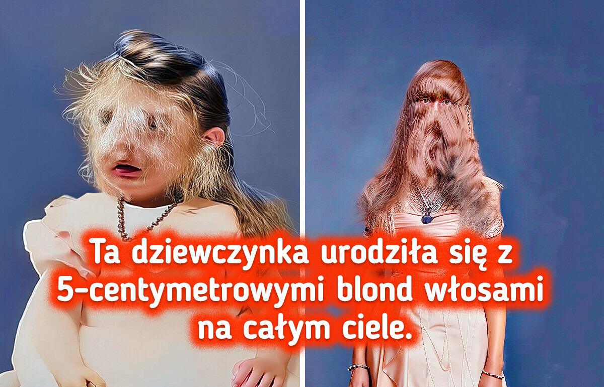 15 zdumiewających fotografii, które dowodzą, że ludzkie ciało to prawdziwe arcydzieło 15 zdumiewających fotografii, które dowodzą, że ludzkie ciało to prawdziwe arcydzieło