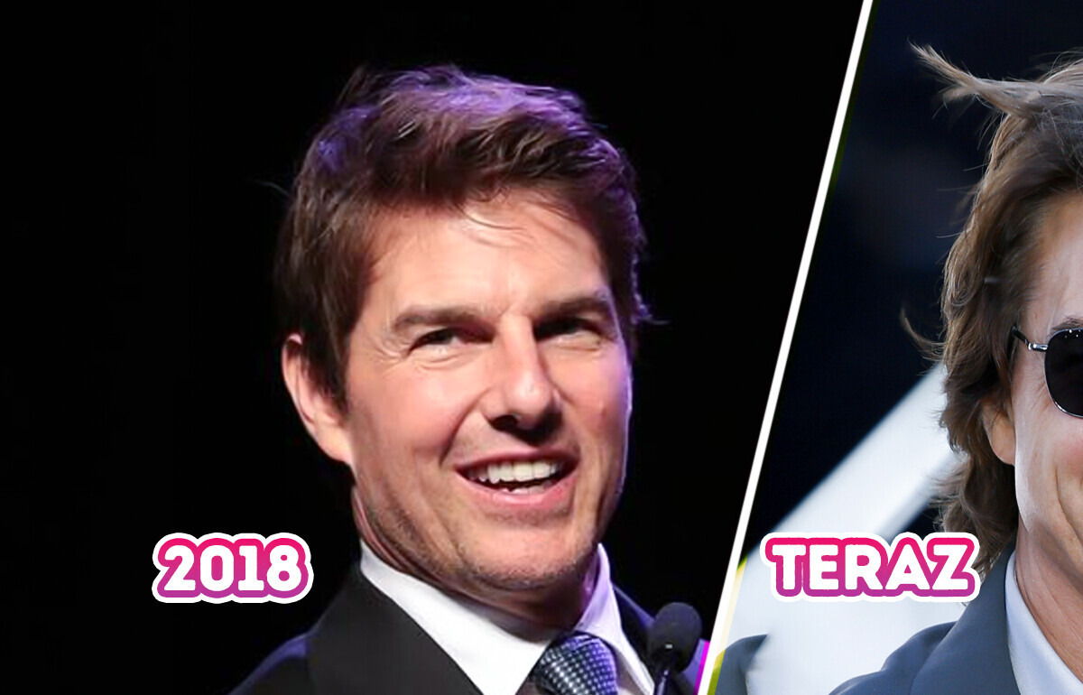 „Dość tych liftingów” — zmiany w wyglądzie Toma Cruise’a wzbudzają podejrzenia, że przesadza z wypełniaczami „Dość tych liftingów” — zmiany w wyglądzie Toma Cruise’a wzbudzają podejrzenia, że przesadza z wypełniaczami