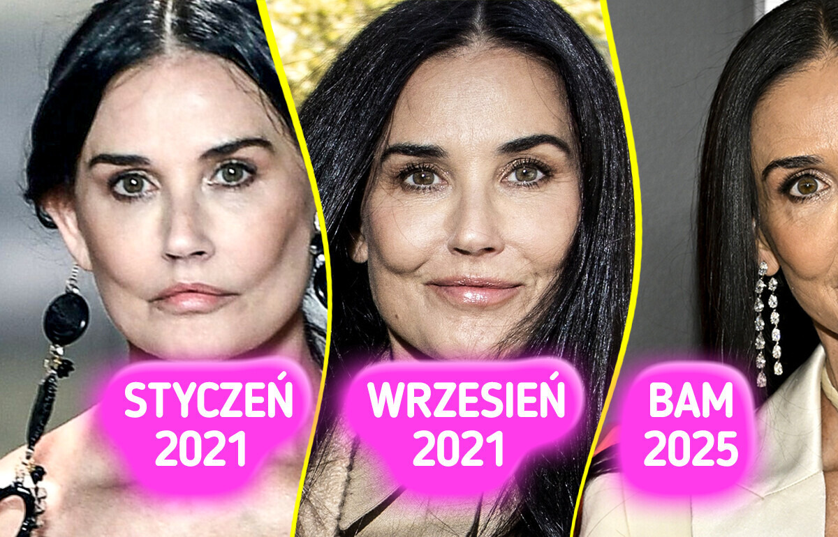 Twarz Demi Moore pod lupą — eksperci ujawniają, co ją zmieniło