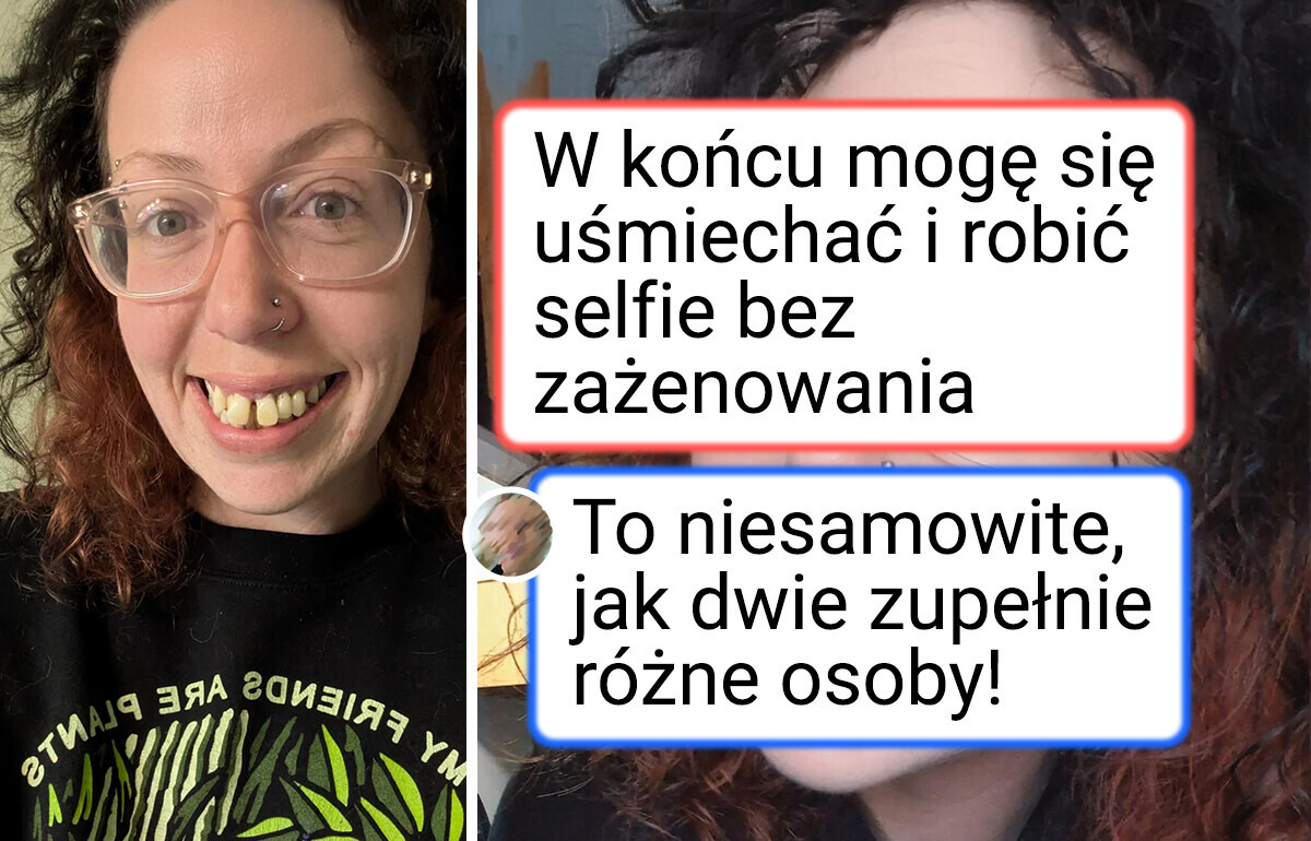 13 porównań zdjęć, które udowadniają, że ludzie są w stanie zmienić się nie do poznania