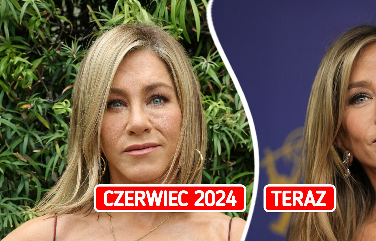 Jennifer Aniston szokuje nowym wyglądem – oficjalnie pożegnała się z wypełniaczami