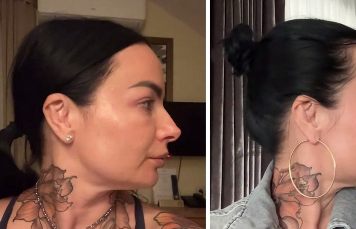 „Kupa groszy i prawie żadnej różnicy”: Kamila Wybrańczyk pokazała wideo z nowym nosem po operacji plastycznej