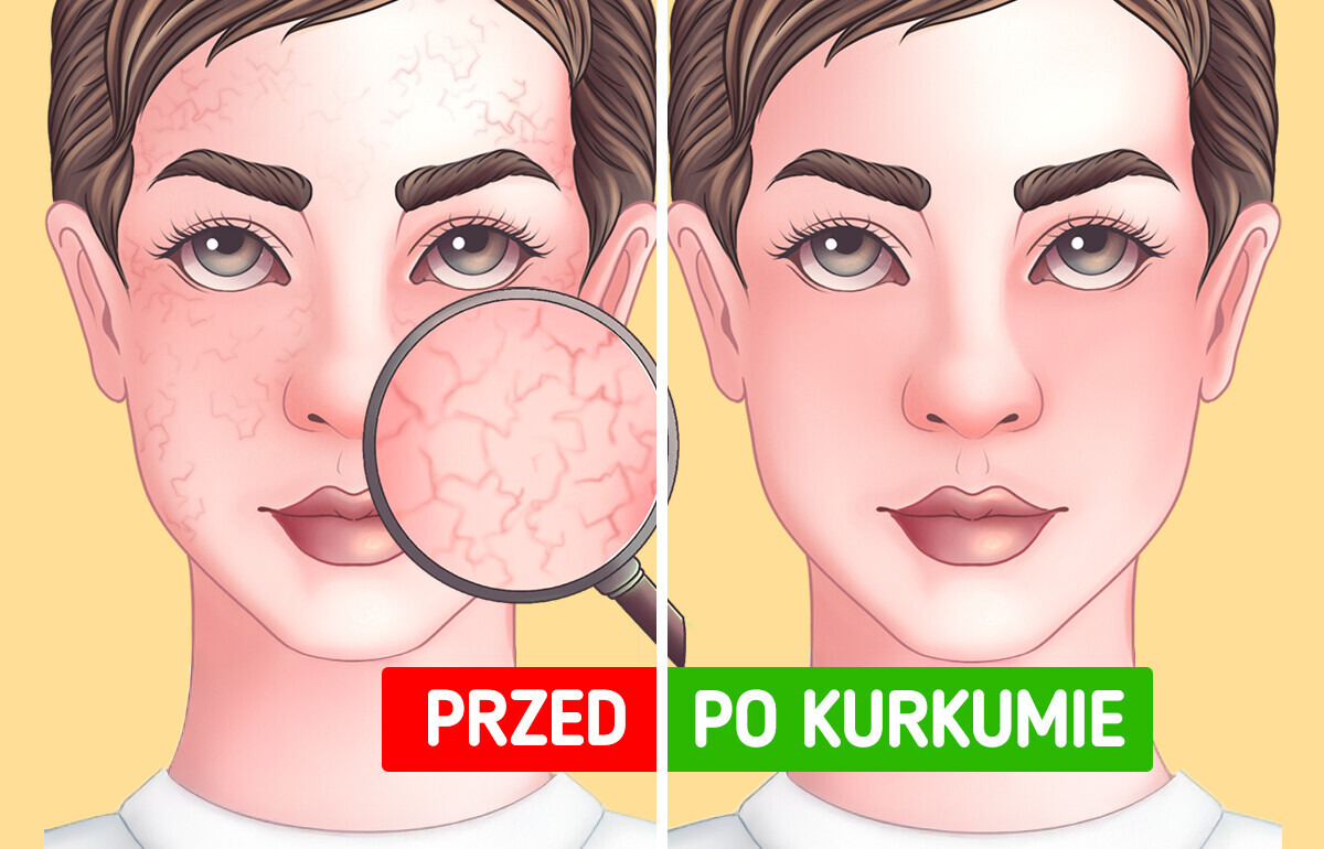 Co dzieje się z ciałem, gdy codziennie pijesz shoty z kurkumy?