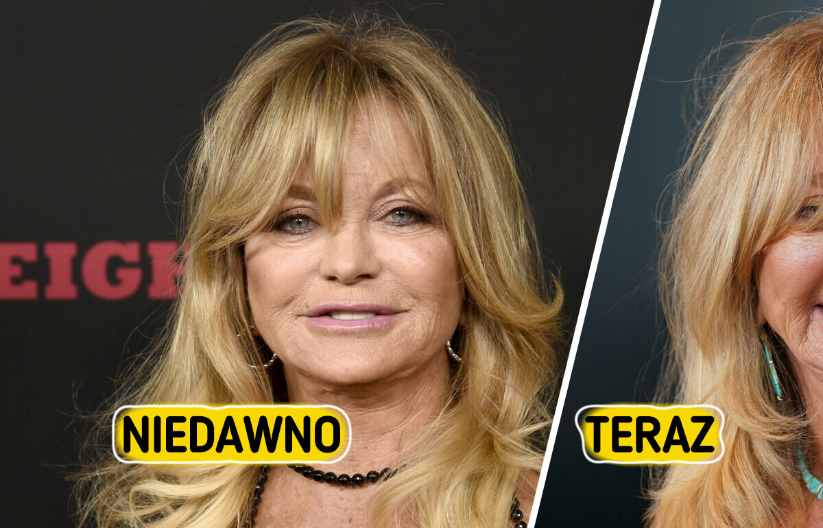 „Co z jej ustami?” — Goldie Hawn olśniewa na czerwonym dywanie, ale niektórzy mówią tylko o jednym