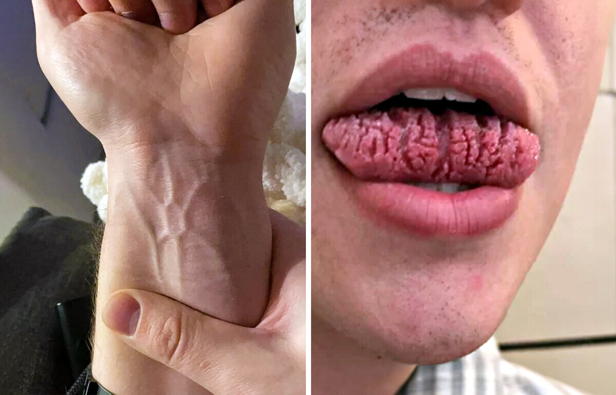 18 przypadków, gdy genetyka obdarzyła ludzi czymś absolutnie wyjątkowym 18 przypadków, gdy genetyka obdarzyła ludzi czymś absolutnie wyjątkowym