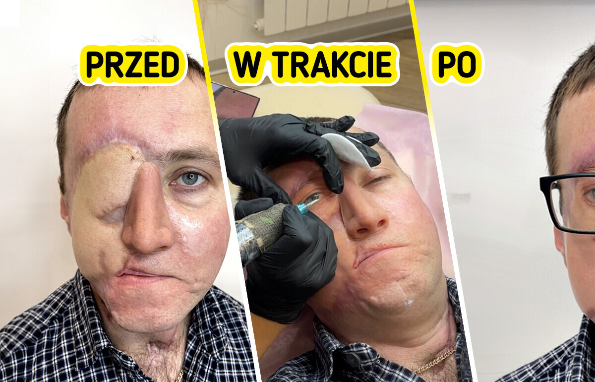 Niesamowity dar tatuażystki dla mężczyzny, który stracił oko w wypadku Niesamowity dar tatuażystki dla mężczyzny, który stracił oko w wypadku