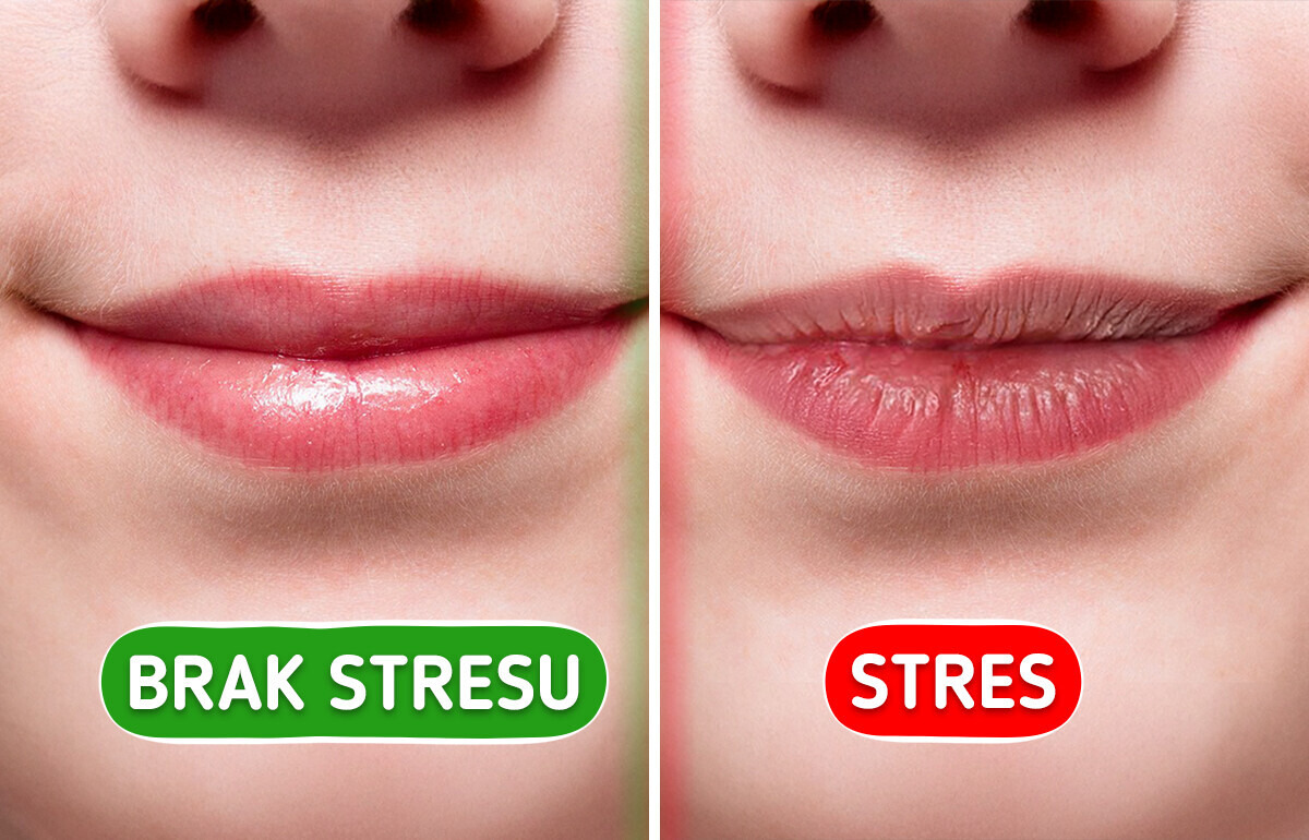 7 znaków, którymi ciało daje znać o stresie 7 znaków, którymi ciało daje znać o stresie