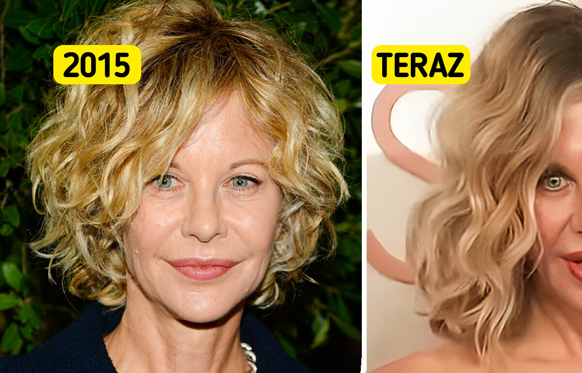 „To nie Meg Ryan” – wygląd aktorki wzbudził niepokój „To nie Meg Ryan” – wygląd aktorki wzbudził niepokój