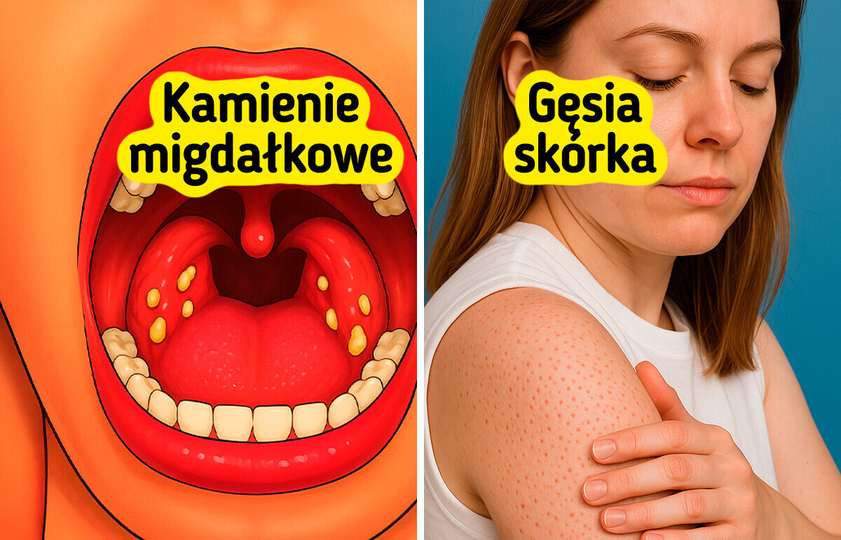 14 oznak, że twoje ciało może być wrażliwe na gluten