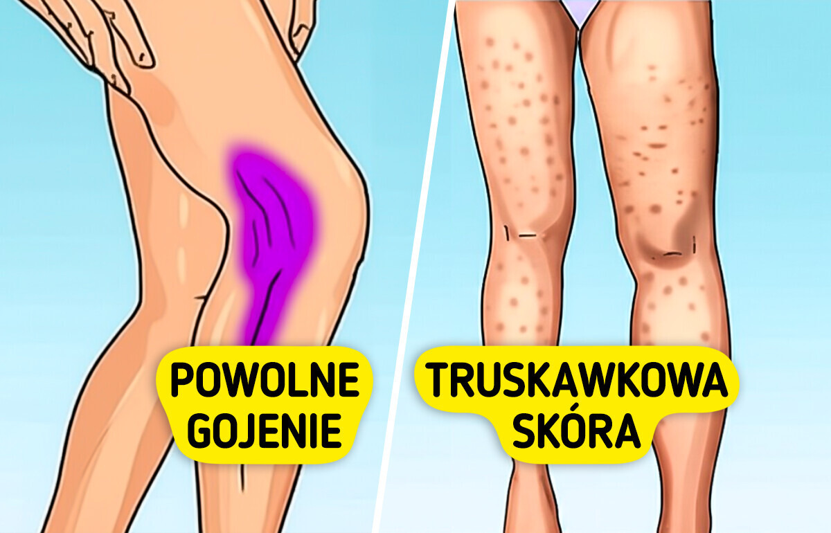 7 oznak niedoboru kolagenu, które możesz zauważyć w swoim ciele