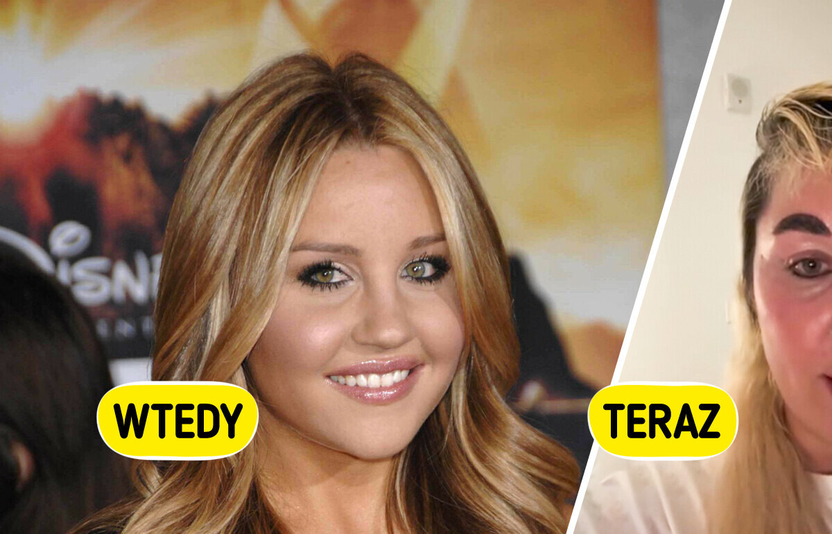 Drastyczna zmiana w wyglądzie Amandy Bynes niepokoi fanów Drastyczna zmiana w wyglądzie Amandy Bynes niepokoi fanów