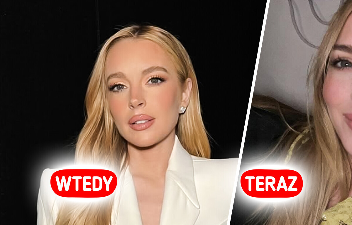 Lindsay Lohan pokazuje nowe zdjęcia i wszyscy widzą „przeszczep twarzy” Lindsay Lohan pokazuje nowe zdjęcia i wszyscy widzą „przeszczep twarzy”