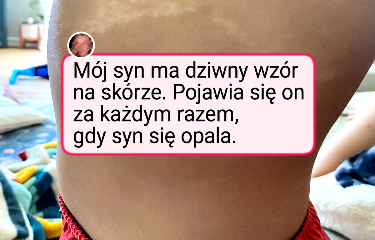 15 osób, które dostały wyjątkowy prezent od natury