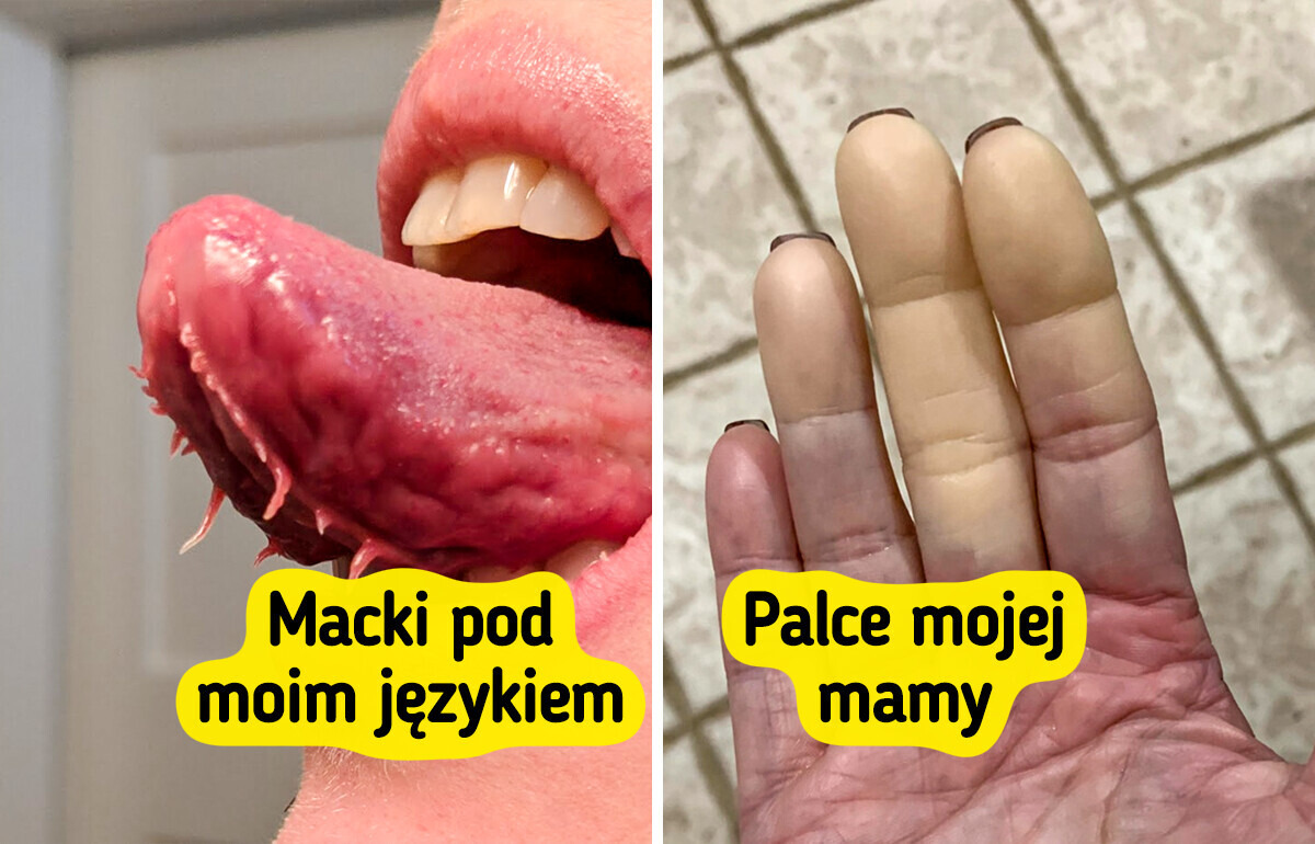 15 osób, które wyglądają jak przerobione w Photoshopie — ale to 100% natura 15 osób, które wyglądają jak przerobione w Photoshopie — ale to 100% natura