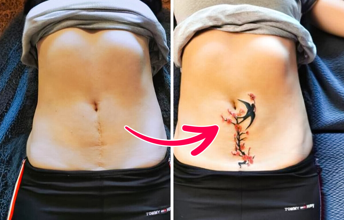 16 tatuażystów, którzy zamienili blizny w dzieła sztuki 16 tatuażystów, którzy zamienili blizny w dzieła sztuki