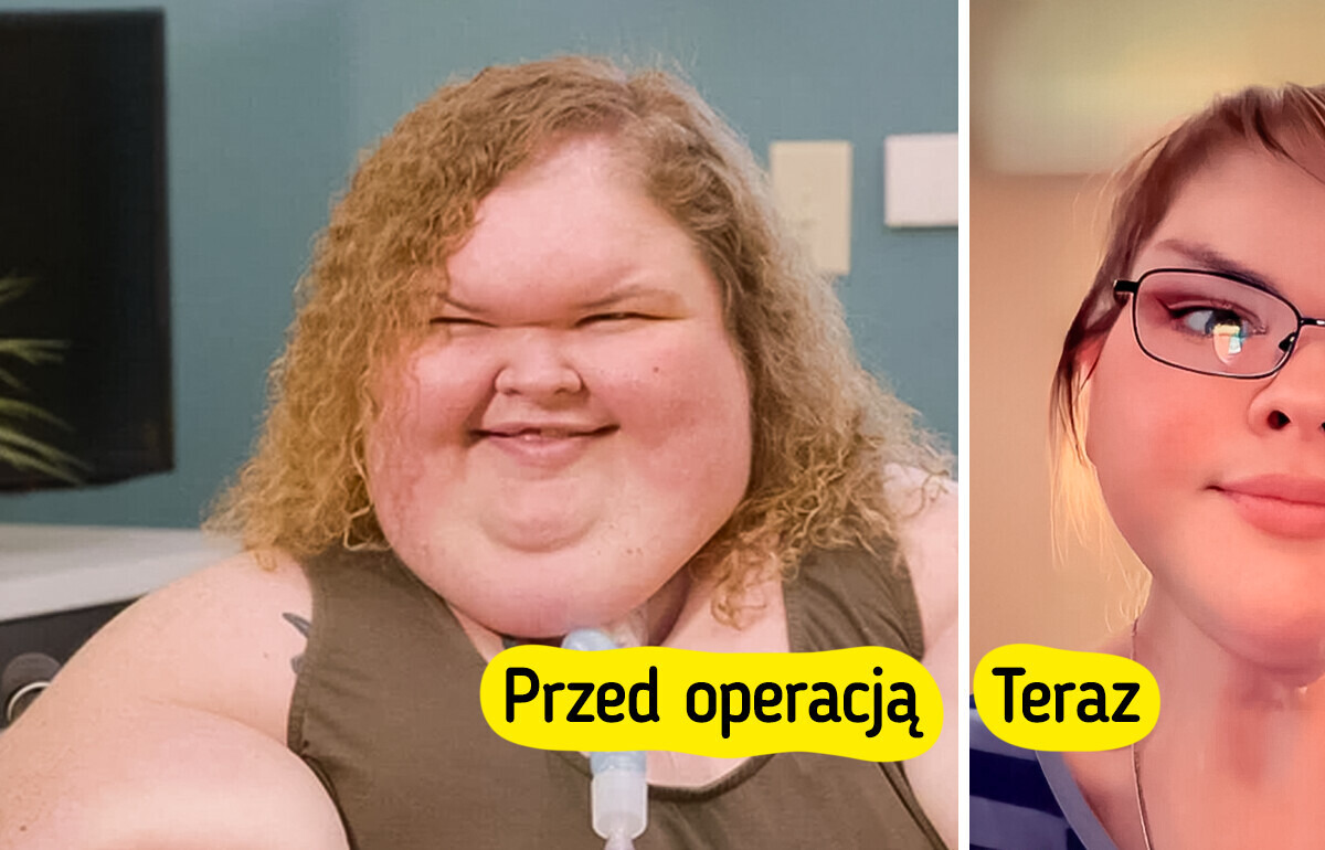 „Jestem z ciebie dumna” — niesamowita przemiana gwiazdy programu „Siostry wielkiej wagi” po operacji usunięcia skóry