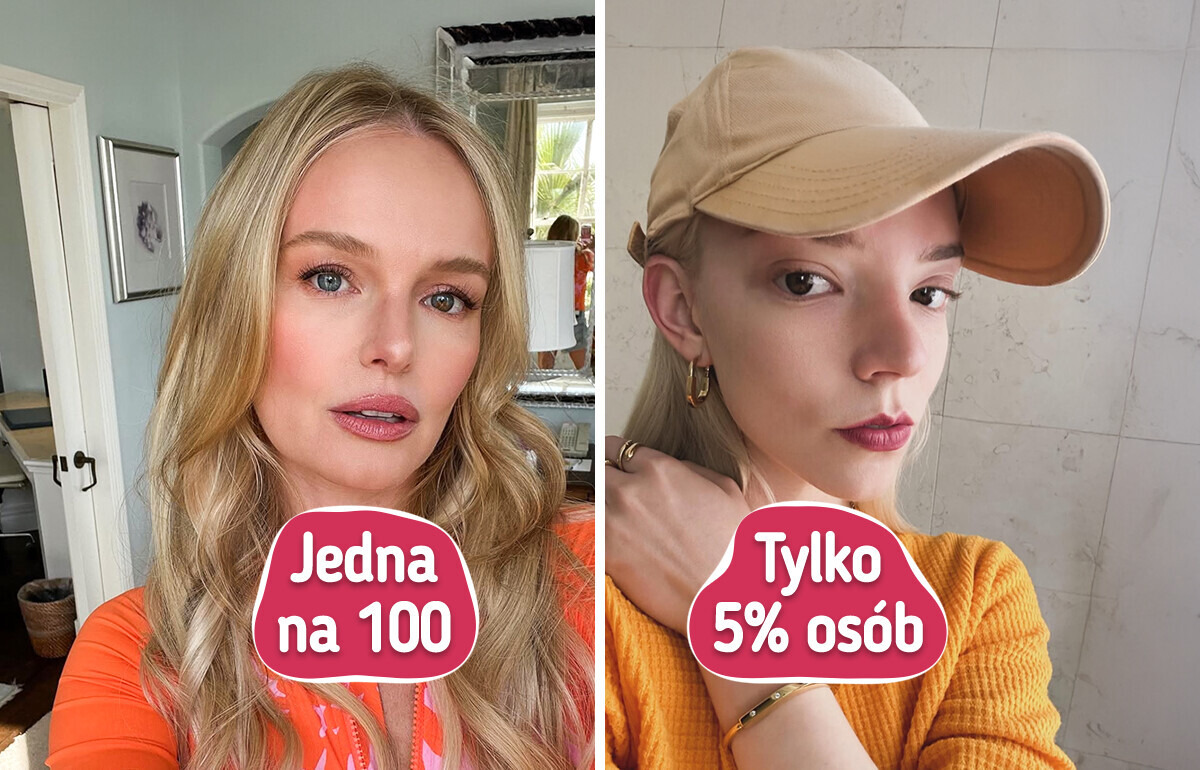 10 wyjątkowych cech wyglądu, którymi wyróżnia się niewiele osób