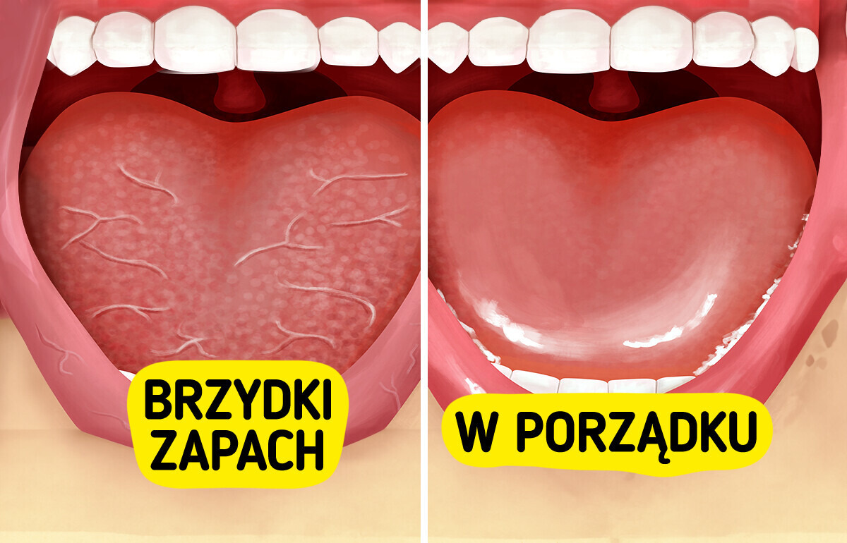 6 efektywnych metod zapobiegania nieświeżemu oddechowi, również po przebudzeniu