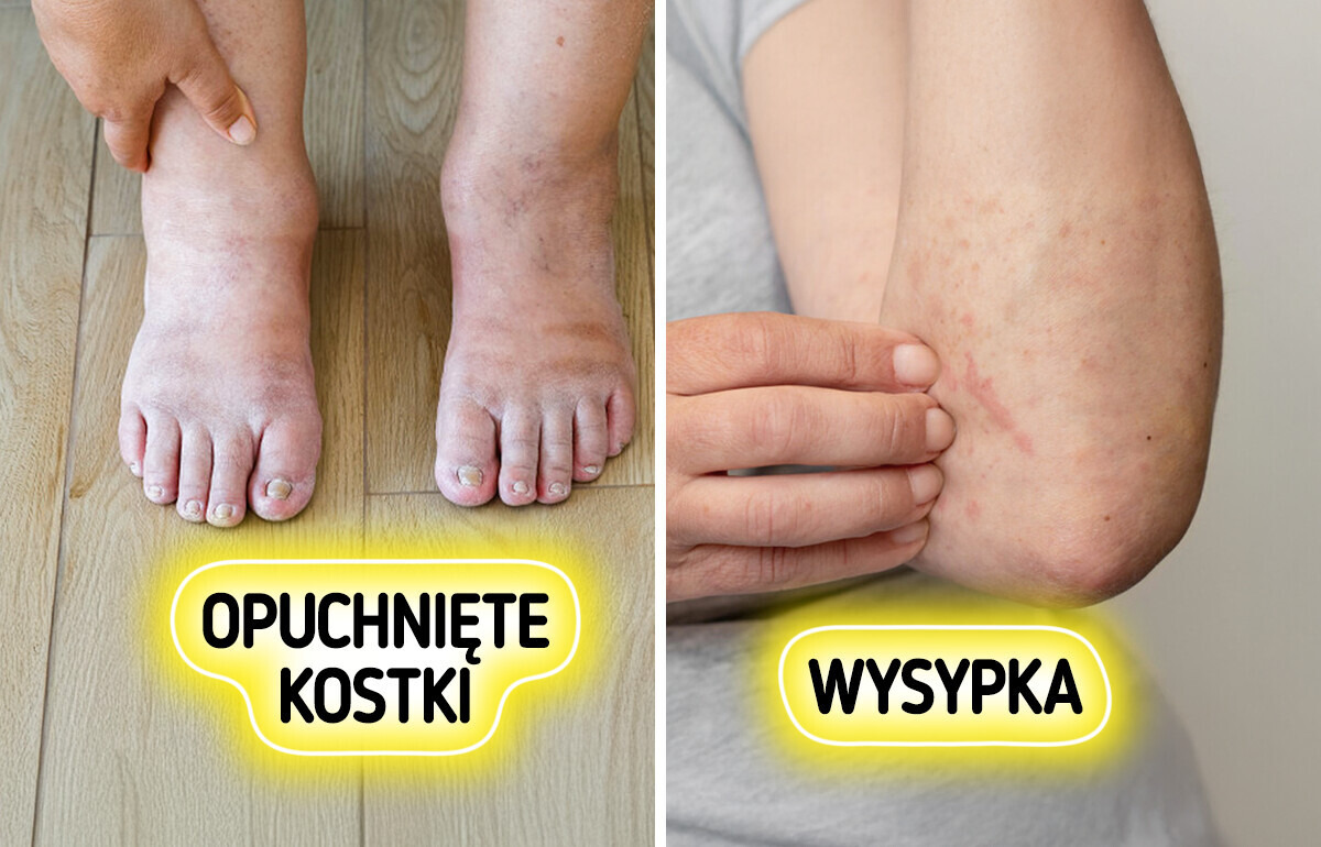 7 ważnych sygnałów, którymi nasze ciało ostrzega nas przed chorobami