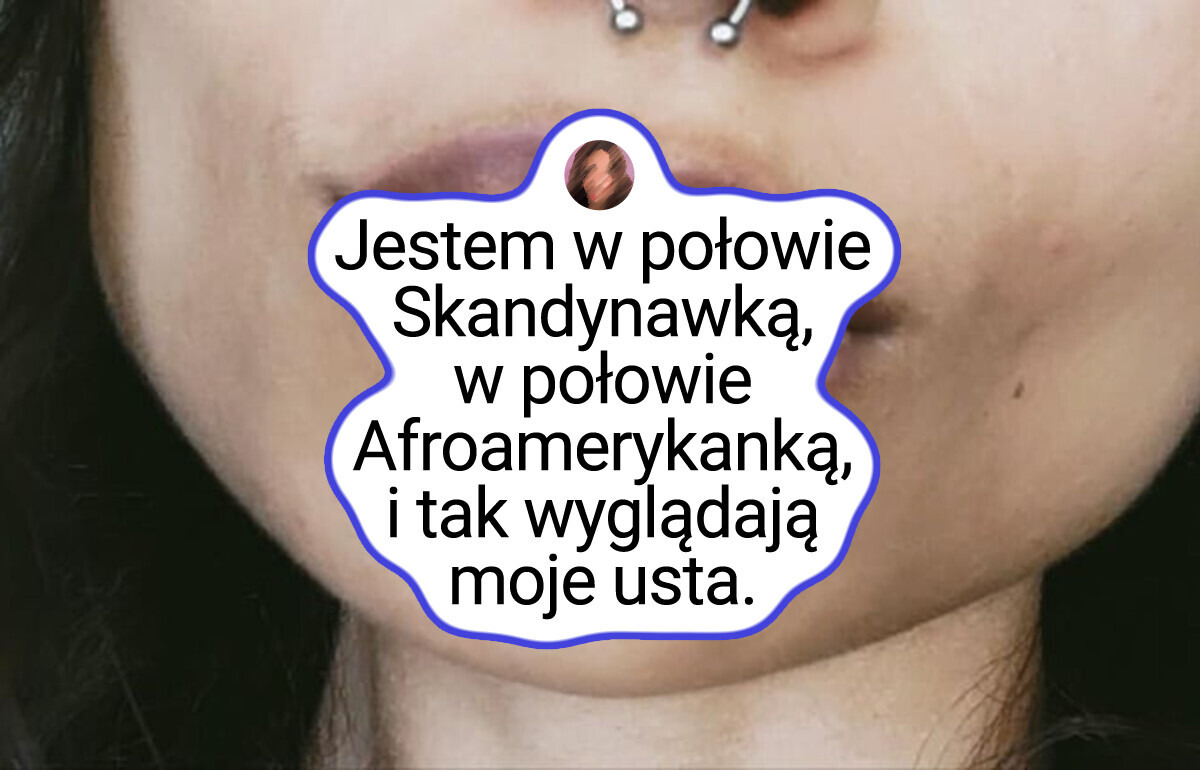 15 fotografii pokazujących ludzi o unikalnych cechach wyglądu