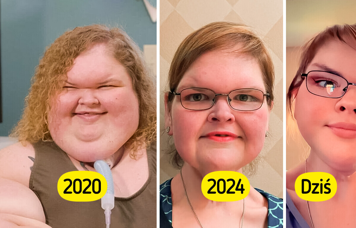 Gwiazda „Sióstr wielkiej wagi” debiutuje po operacji usunięcia nadmiaru skóry. Fani są w szoku