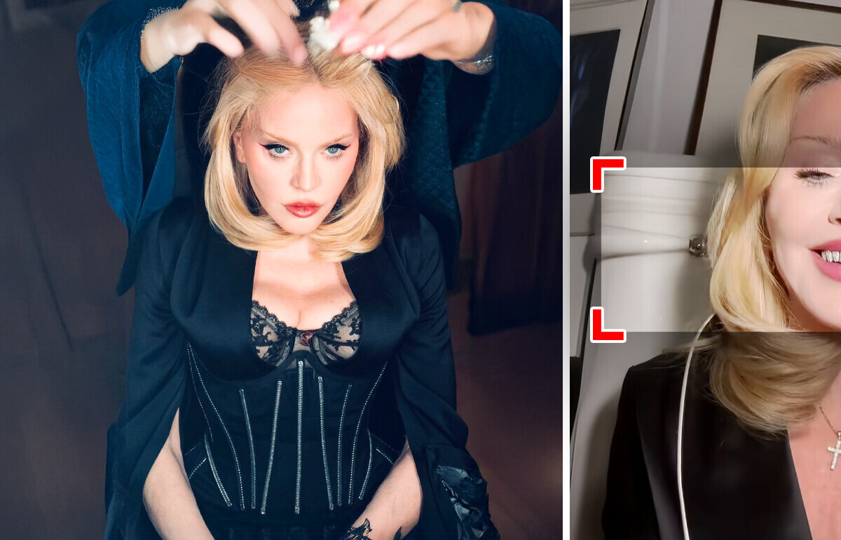 Madonna ma 66 lat i wciąż zaskakuje — tym razem nowymi zębami Madonna ma 66 lat i wciąż zaskakuje — tym razem nowymi zębami