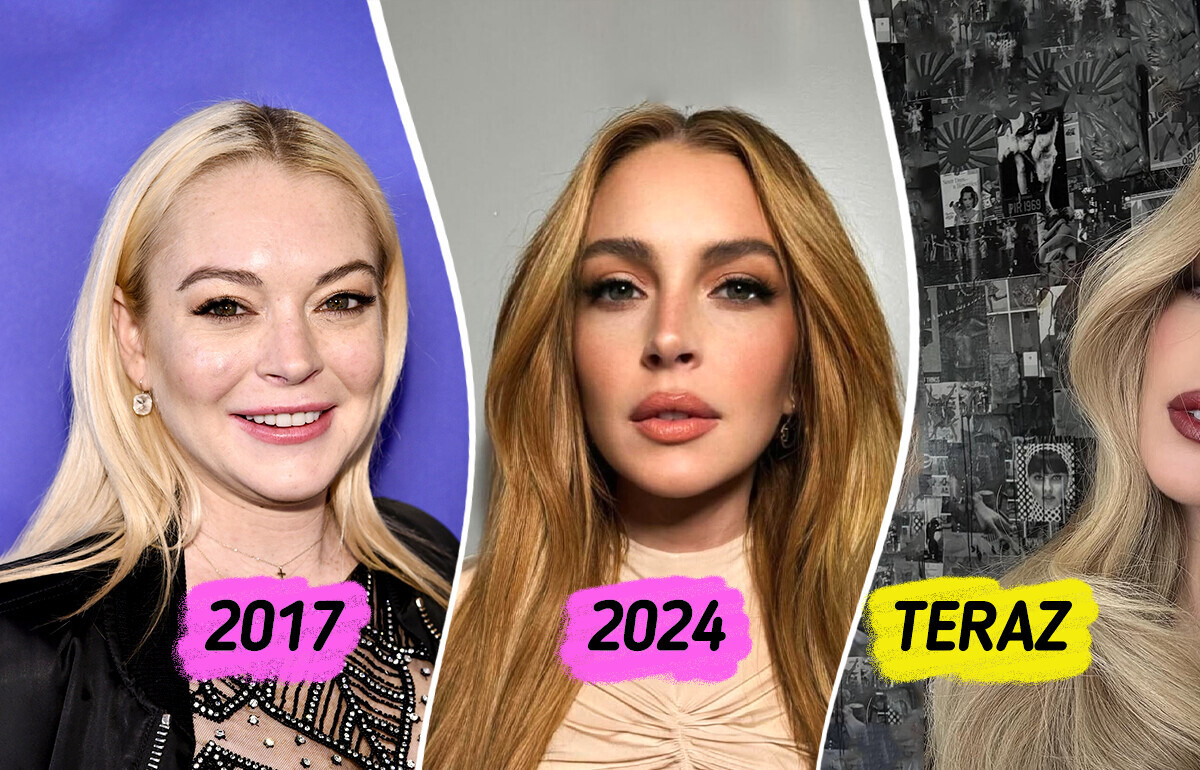 Lindsay Lohan zaskakuje metamorfozą, a ekspert od medycyny estetycznej komentuje jej wygląd