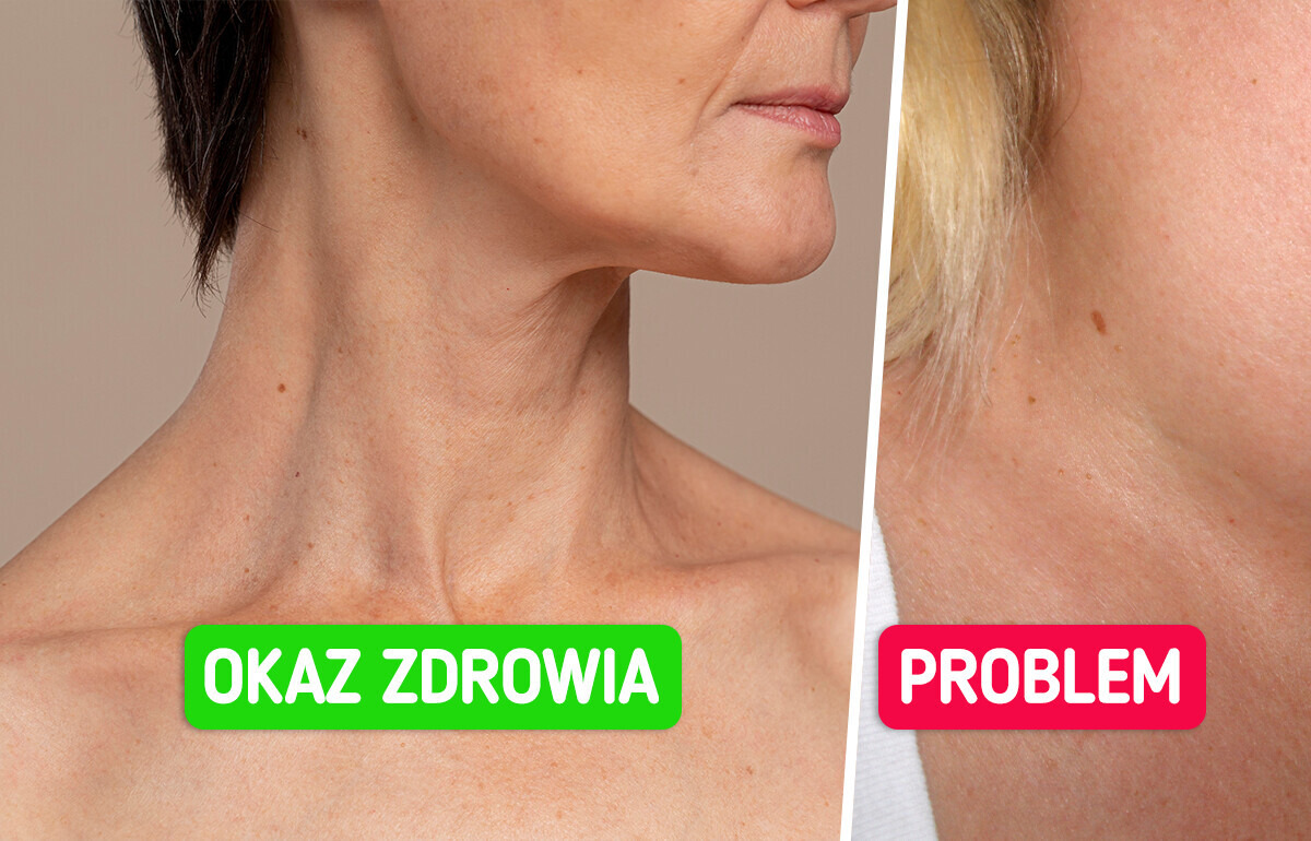 6 objawów, które mogą świadczyć o problemach z tarczycą