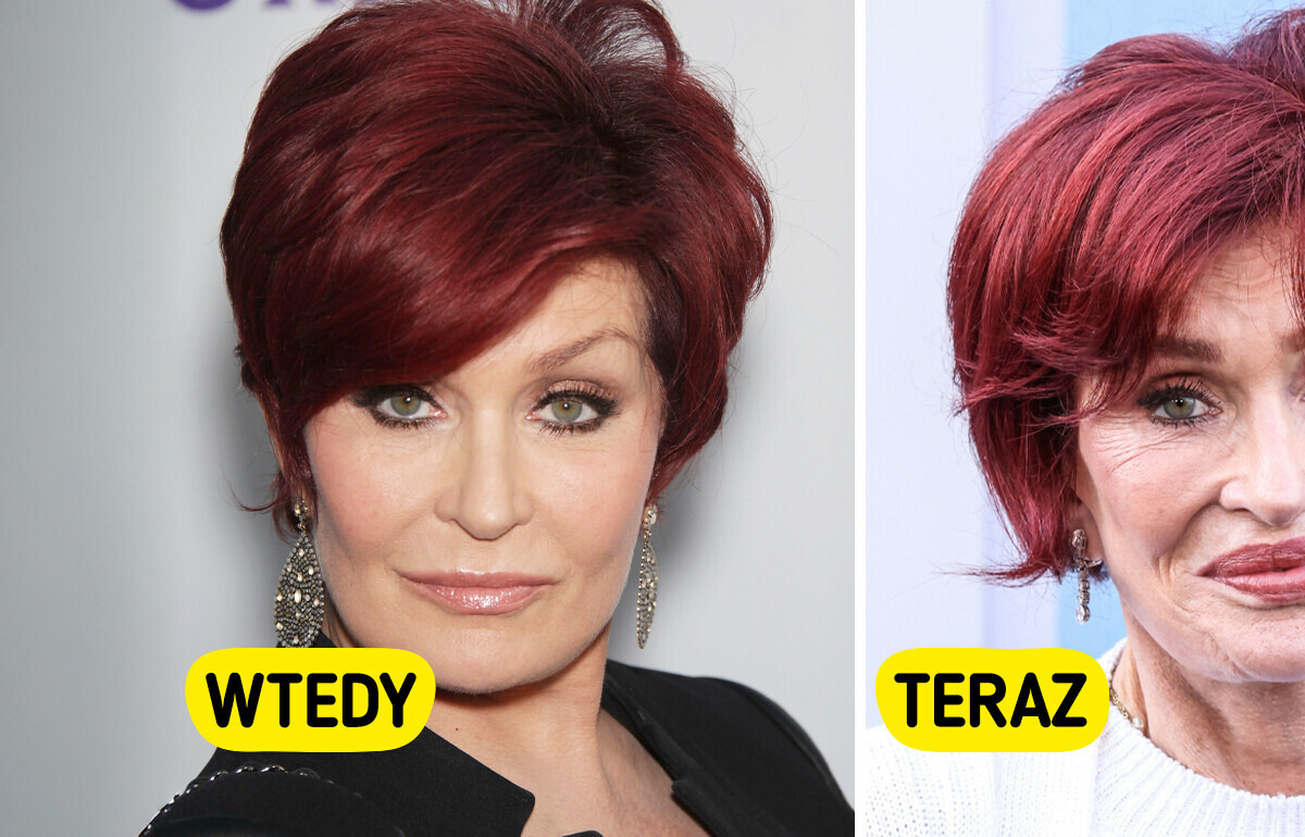 „Chyba przesadziłam” — 72-letnia Sharon Osbourne opowiada o swojej przemianie