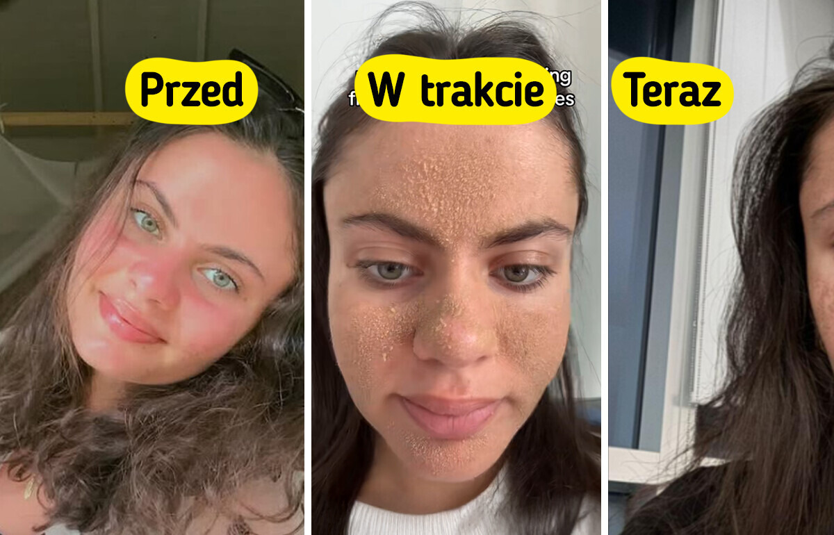 Kobieta przestaje myć twarz w ramach pielęgnacji — jej metamorfoza zaskakuje Kobieta przestaje myć twarz w ramach pielęgnacji — jej metamorfoza zaskakuje
