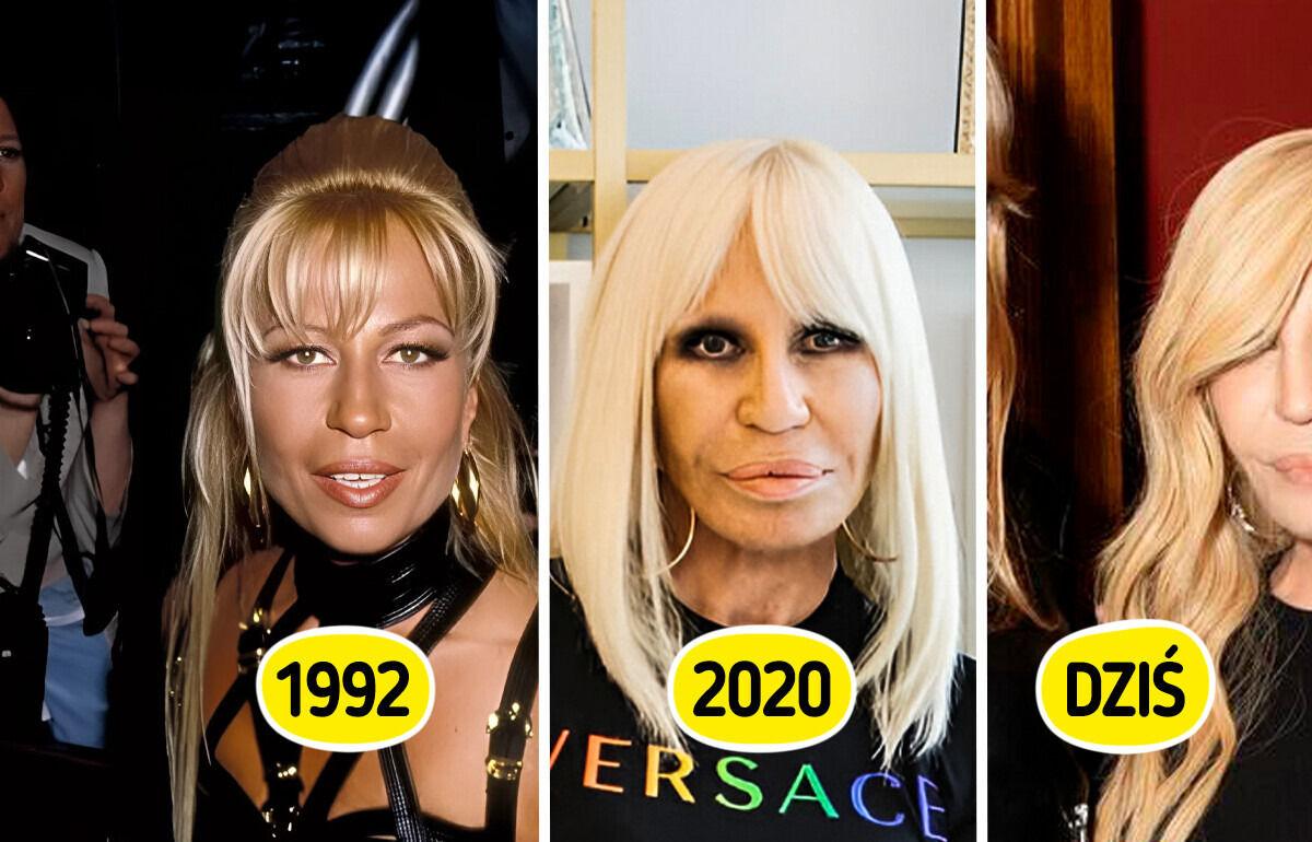 „Wiecznie młoda” — drastyczna przemiana 70-letniej Donatelli Versace wprawia fanów w osłupienie „Wiecznie młoda” — drastyczna przemiana 70-letniej Donatelli Versace wprawia fanów w osłupienie