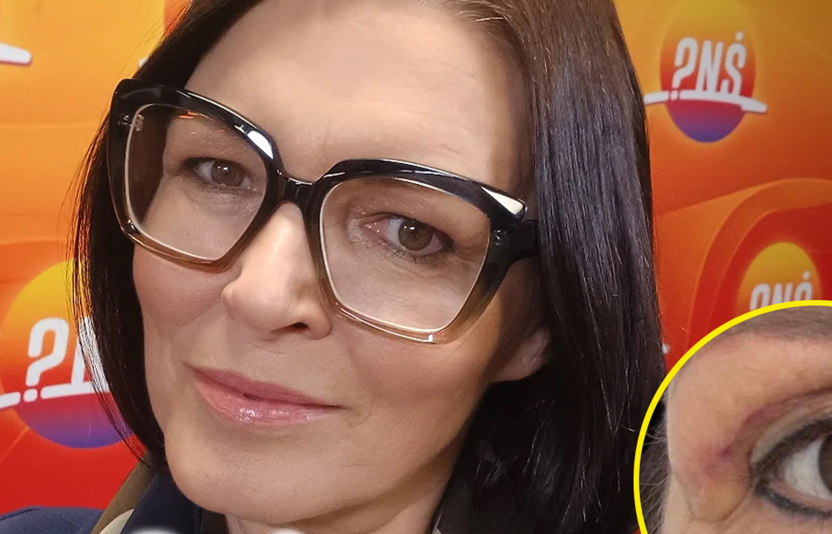 Jak jedna operacja sprawiła, że słynna Ilona Felicjańska zapomniała o swoich zasadach Jak jedna operacja sprawiła, że słynna Ilona Felicjańska zapomniała o swoich zasadach