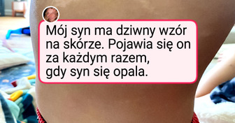 15 osób, które dostały wyjątkowy prezent od natury