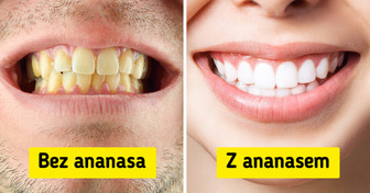 10 metod, dzięki którym twoje zęby będą olśniewająco białe i zdrowe